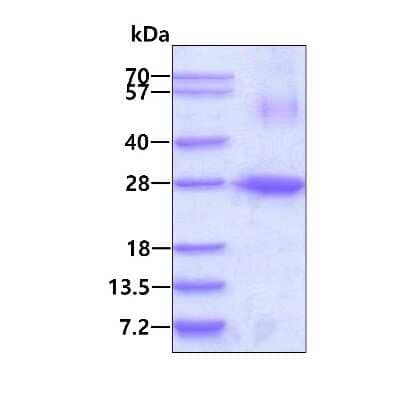 SDS-PAGE: Recombinant Human ARL4 His Protein [NBP1-72396]